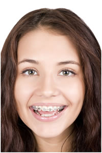 Ortodontik tedavi